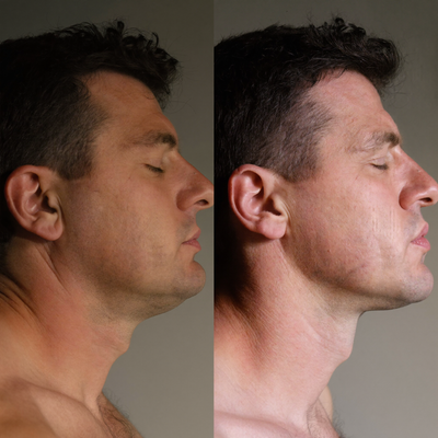 Collagen Face Sculpt Wrap (Buy 1 Get 1 Free)