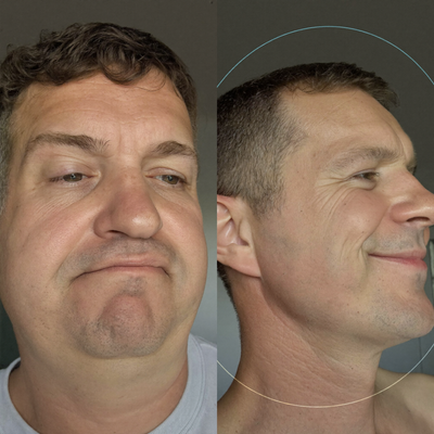 Collagen Face Sculpt Wrap (Buy 1 Get 1 Free)